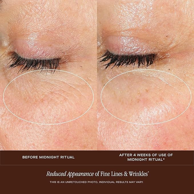 Midnight Renewal Retinol Face Serum - Fine Lines & Tone Correction